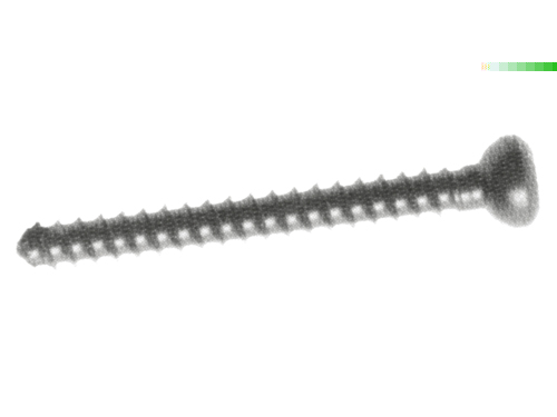 4.5mm Cortical Screws